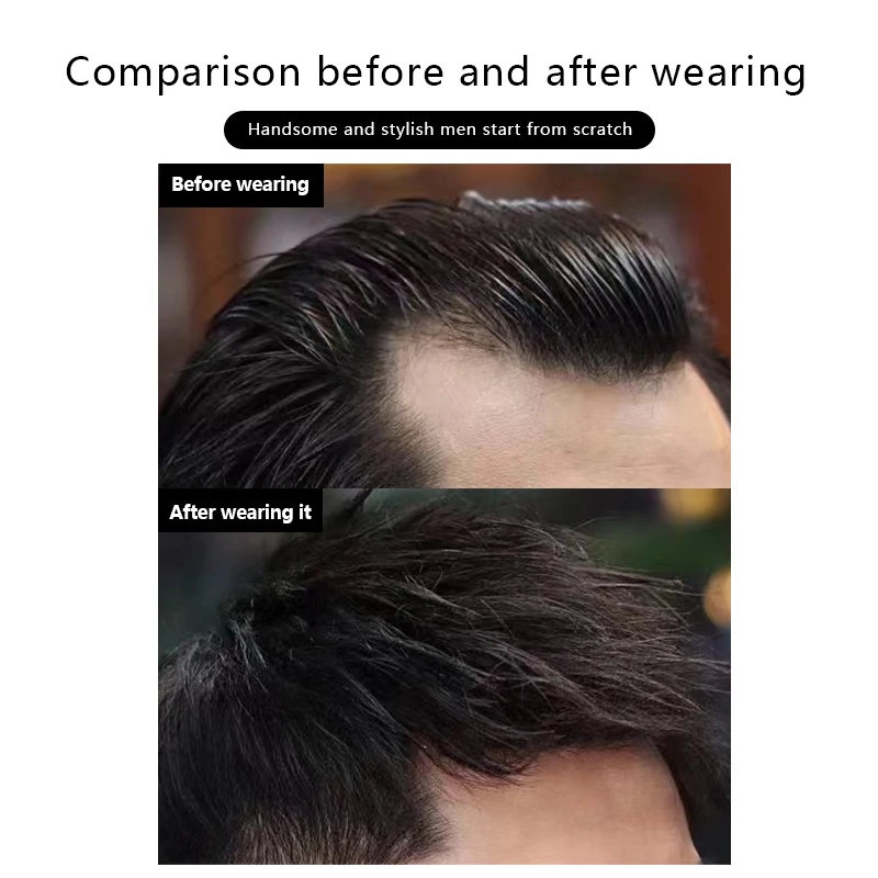 Parche para la frente para hombres, peluquín para patillas, 100% cabello humano, Invisible, sin costuras, piel ultrafina, parche para patillas de línea de cabello de PU