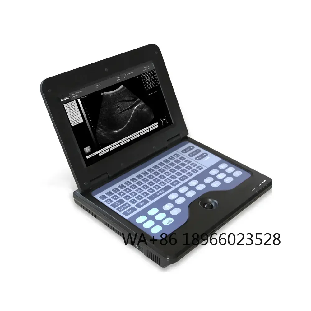 

Ecografo Portatil Veterinary Equipments Combo B-ultrasound Ultrasonido Doppler Portable B Ultrasound Machine CMS600P2