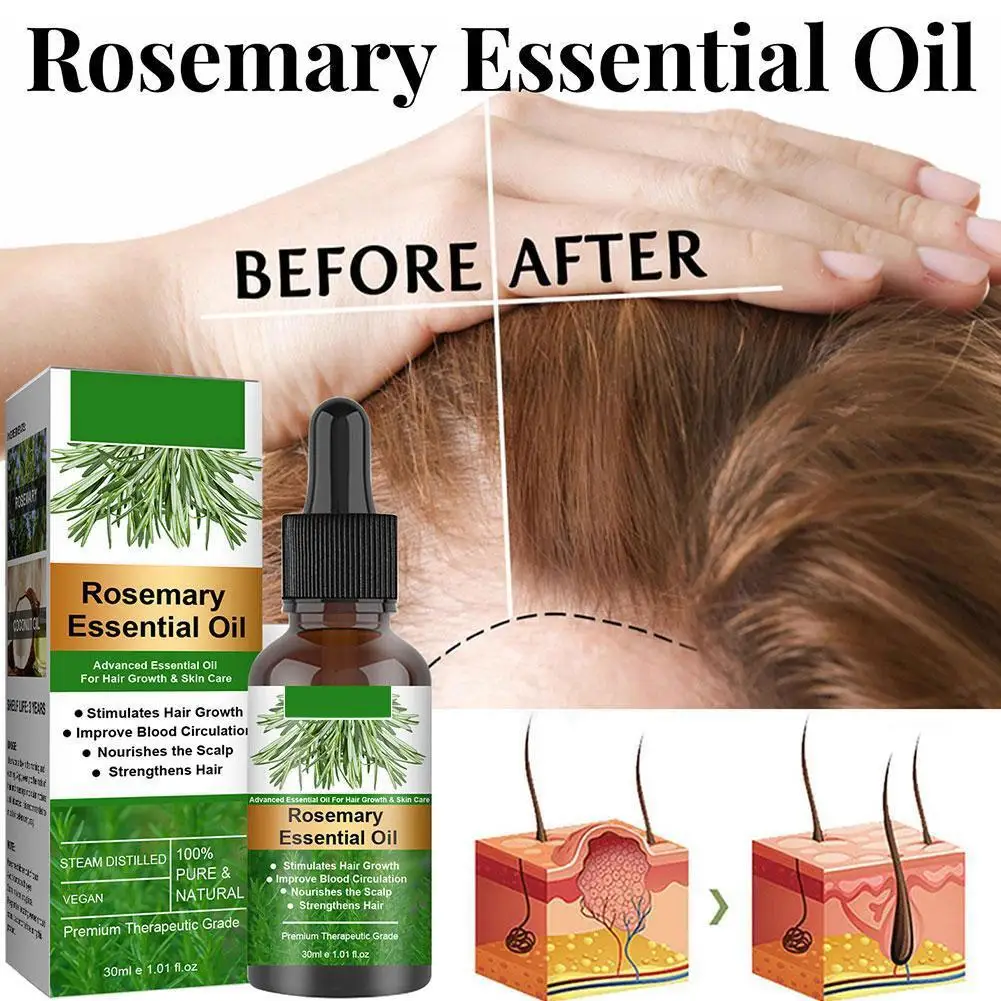 Rosemary-óleo essencial para cuidados com o cabelo, crescimento do cabelo, crescimento do cabelo, 30/50/60ml, crescimento do cabelo, perda de cabelo, perda de cabelo, perda de cabelo, crescimento do cabelo