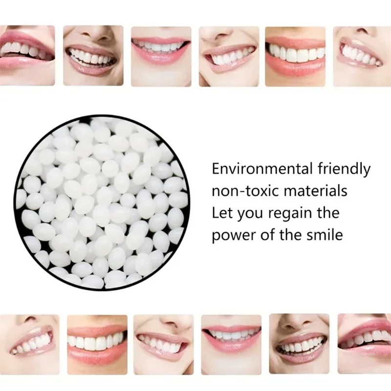 

Resin 100g Temporary Tooth Repair Teeth Gaps False Teeth Solid Glue Denture Adhesive Teeth Whitening-Tooth Beauty