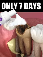 2025 Productos calientes, herramientas para el cuidado de limpieza de dientes, envío gratis, espuma oral