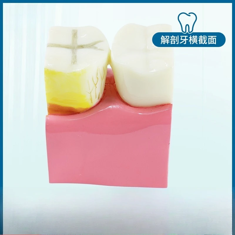 Anatomical tooth cross-section  root  nerve observation teaching comparison  dental learning  model