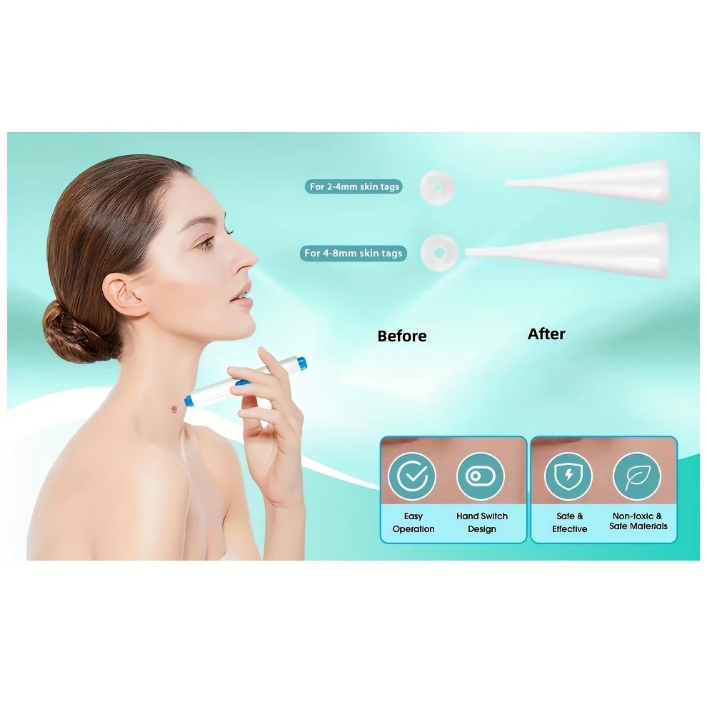 Kit d'élimination 1/2/4 pièces pour les soins de la peau, conception conviviale à une main, sûr et efficace pour un usage domestique