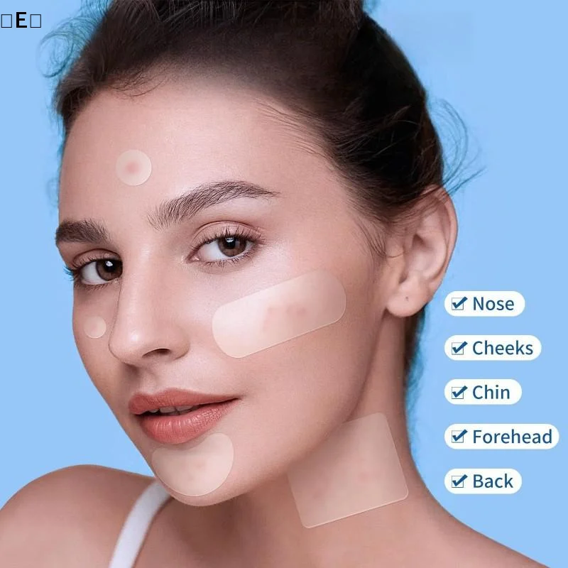 〔E〕380pcs Hydrocolloid Acne Patch Gentle And Non-Irritating To Cover Acne And Blemishes, Acne Patch Facial Skin Cover〔Winter5〕