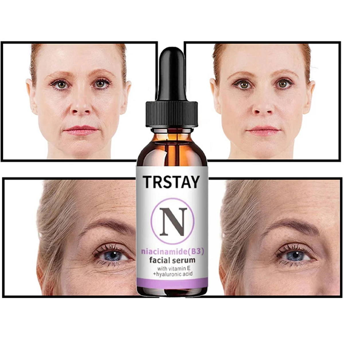 

TRSTAY Nicotinamide (B3) facial essence liquid accelerates collagen regeneration, dilution, drying and fine lines