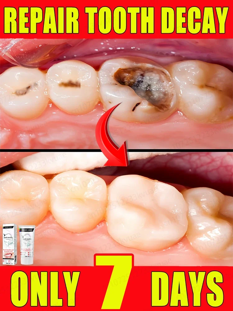 Repair tooth decay, remove plaque and periodontitis. Whiten teeth and eliminate bad breath