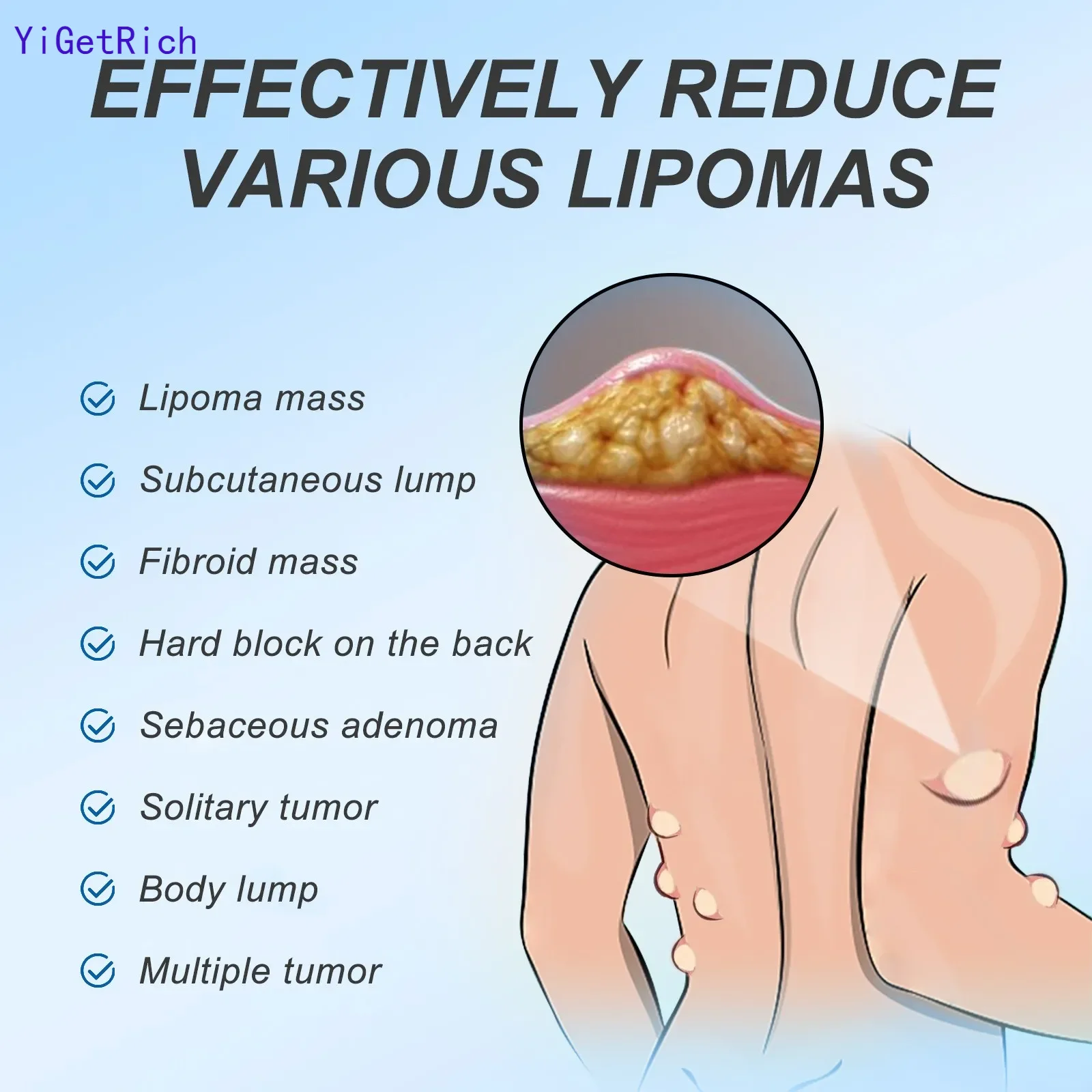 Lipoma Ointment, Lipoma Removal Paste Natural Herbal Lipoma Lump Removal Paste Lipoma Removal Paste Ointment Festival Gifts