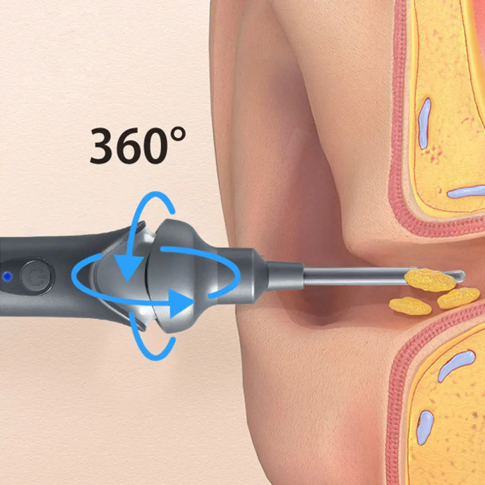 Limpiador de oídos con cámara y luces LED, removedor de cera al vacío eléctrico, 2 engranajes, inalámbrico, para el cuidado de la salud del oído
