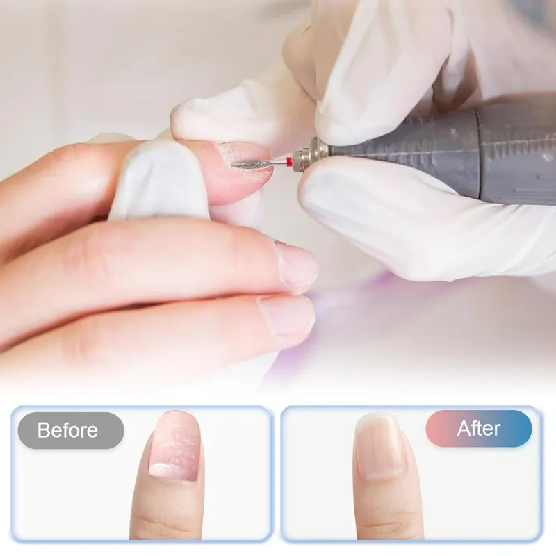 A Set for Nail Dead Skin Cuticle Cleaner Pre-treatment Tools  Diamond Nail Drill Bits Pro Russian Cuticle Clean Bit