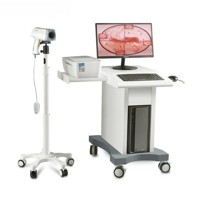 CE approved KERNEL KN2200 digital video  for gynecology cervix vagina examination