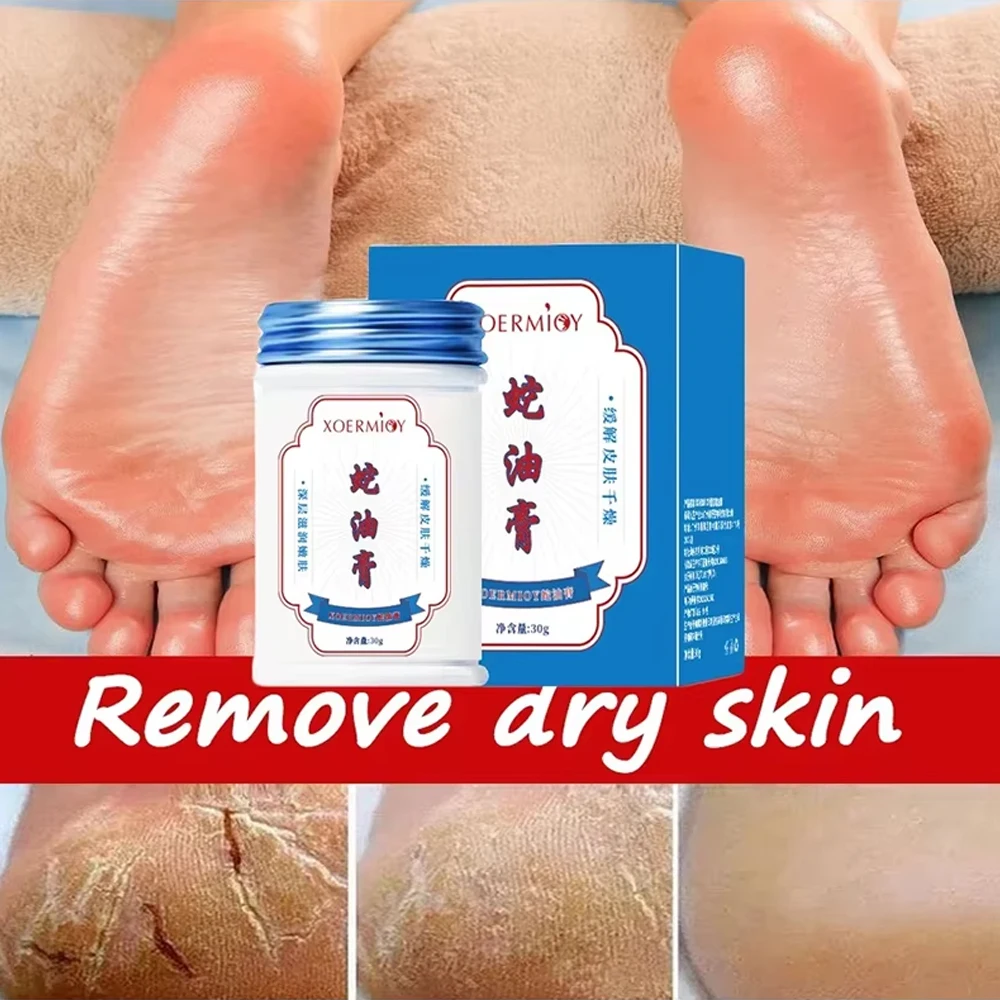 

Herbal Anti Crack Foot Cream Heel Cracking Repair Products Exfoliation Dead Skin Removal Softening Moisturize Smooth Skin Care