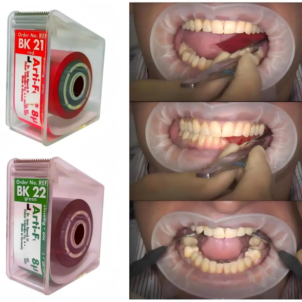 Dental Bausch Arti-Fol 8µm Occlusion Film Dental Shimstock Bite Indicator 20m Roll for Highly Polished Ceramic or Metal Surfaces