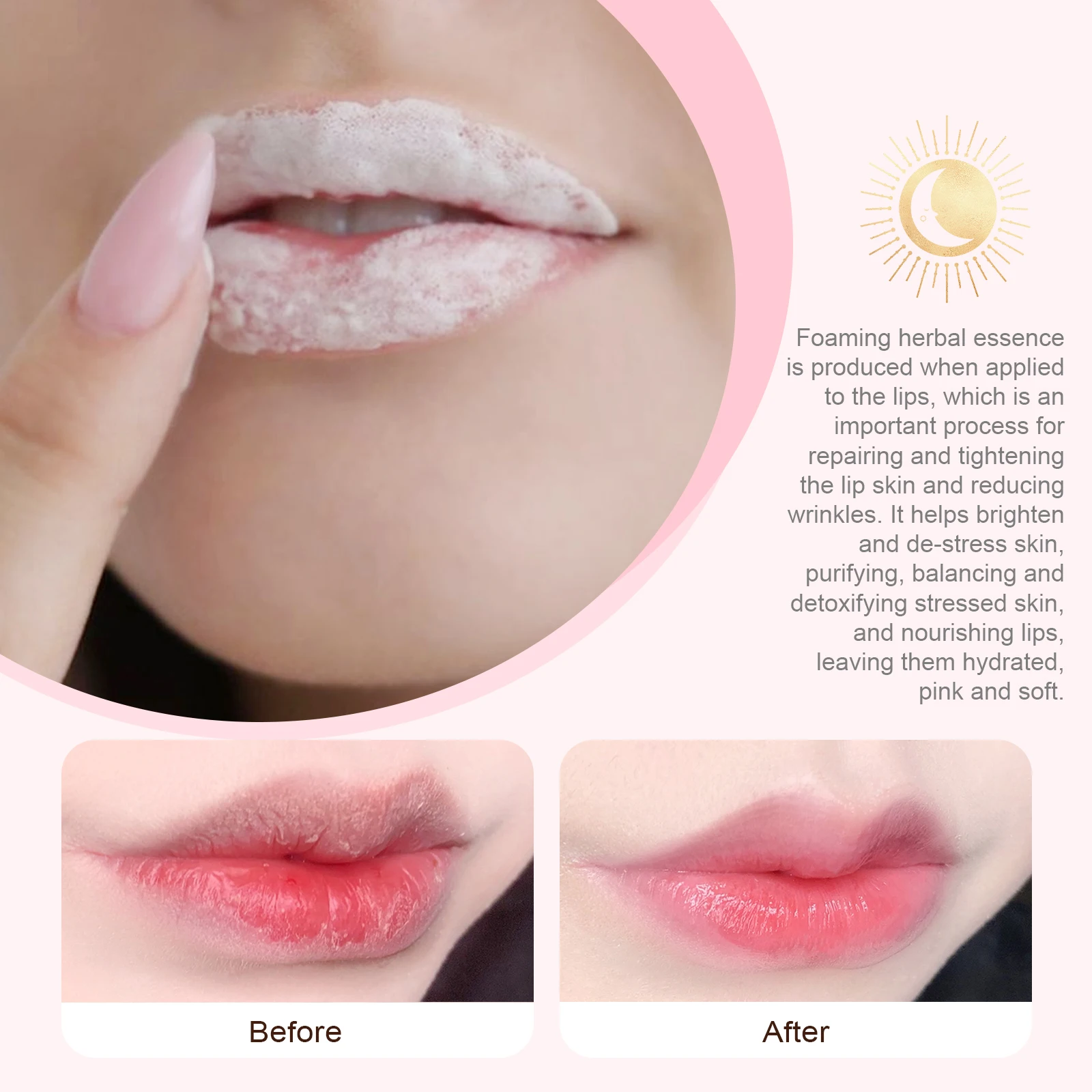 EELHOE Bubble Lip Balm Reduces Lip Lines Remove Dead Skin Fade Lip Line Anti Cracked Moisturizing Lightening Pigment Lip Balm