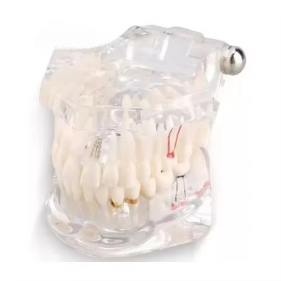 

Dentals Model Dentals Materials Doctor-Patient Communication Model