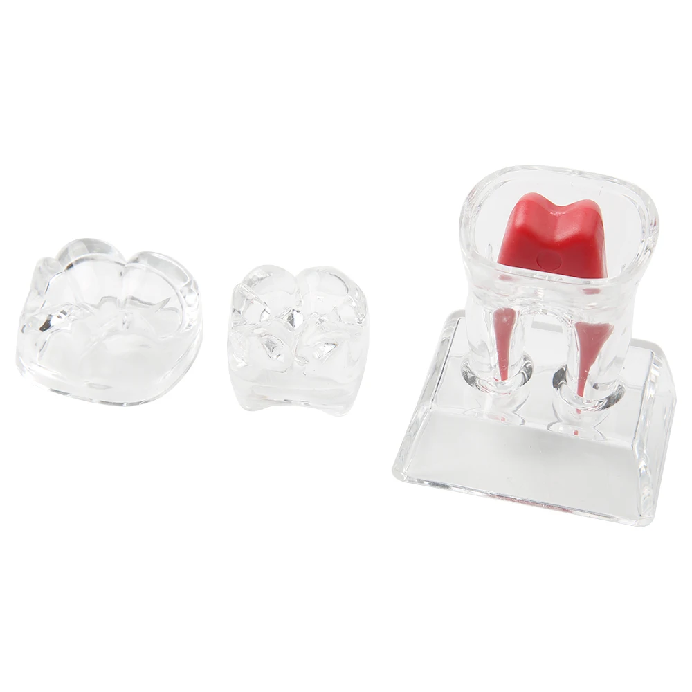 Dental Model Decomposable Dental Model Transparent Dental Teaching Model Transparent Small Ornament