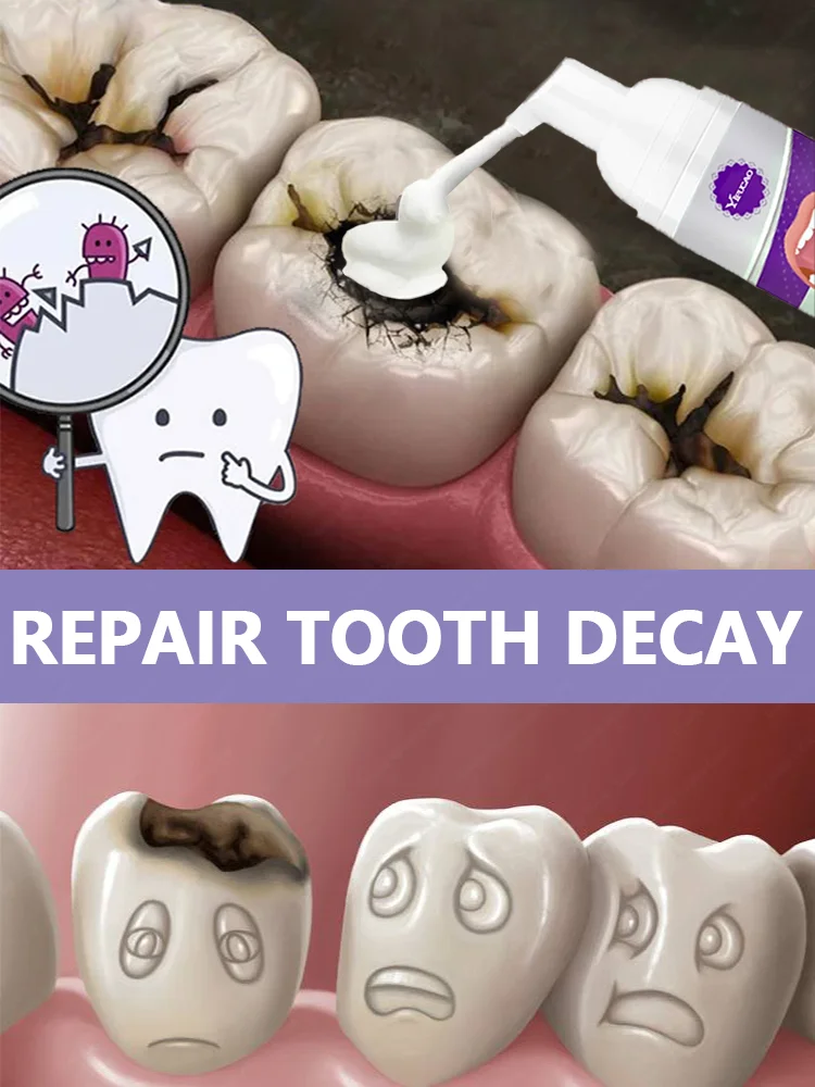 Resuelve el problema de caries y decay de dientes.