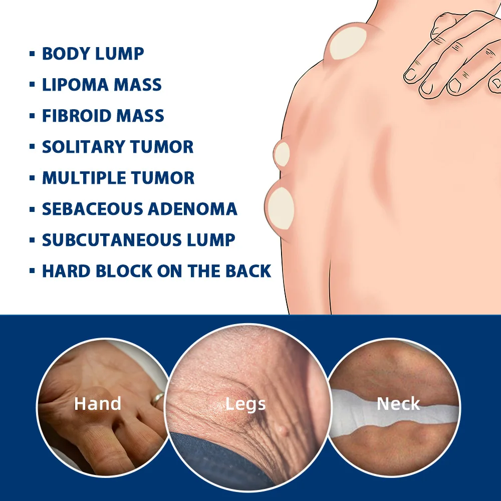 ครีมบำรุงผิวหน้า ฟาตคัง แคร์ ครีมญี่ปุ่น ครีมซ่อมแซมผิวคล้ำ ลดรอยดำ รุ่น K10165