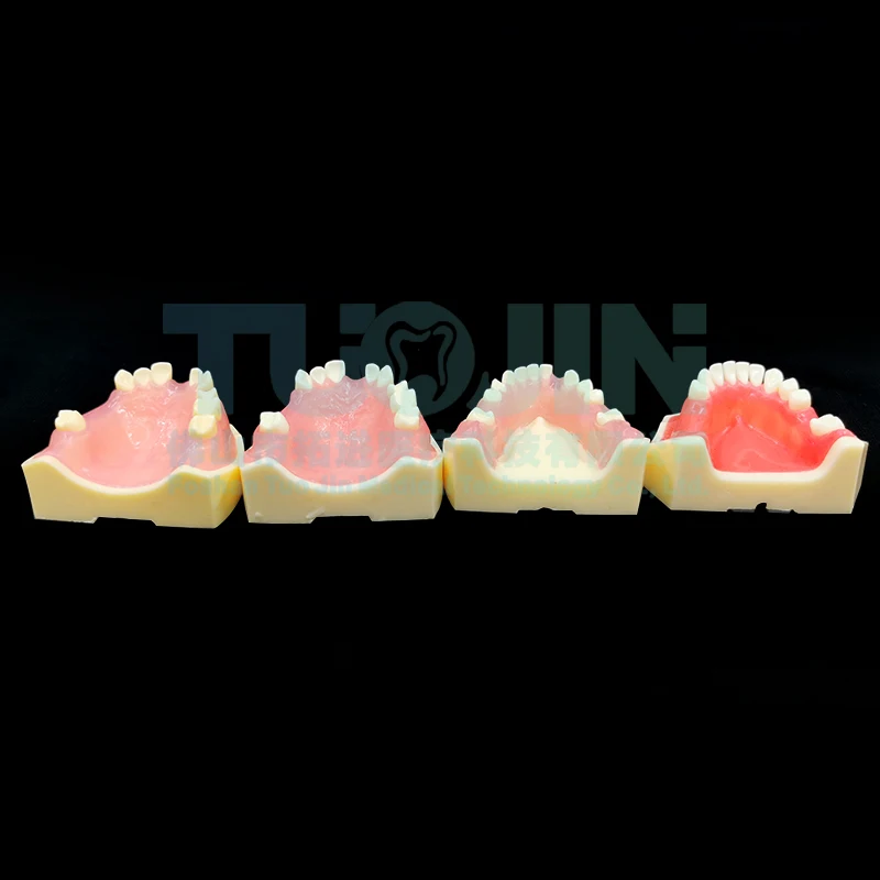 

Модель практики имплантата, зубная нижняя щелочка с мягкими деснами для стоматолога, обучения студентам, обучающая демонстрационная модель клиники