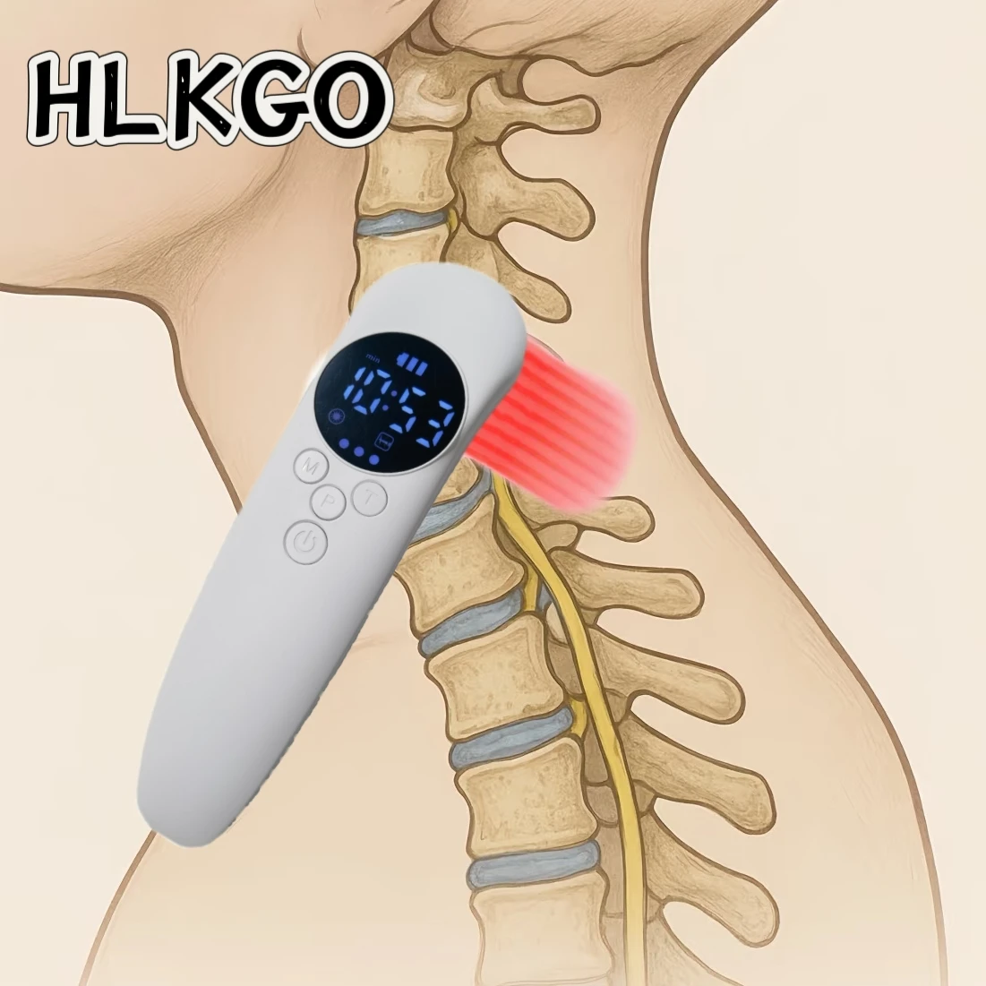

HLKGO 650 нм, 17 диодов, устройство для лазерной терапии для облегчения боли в нейропатии, терапия красным светом для домашнего использования, ускорение заживления ран
