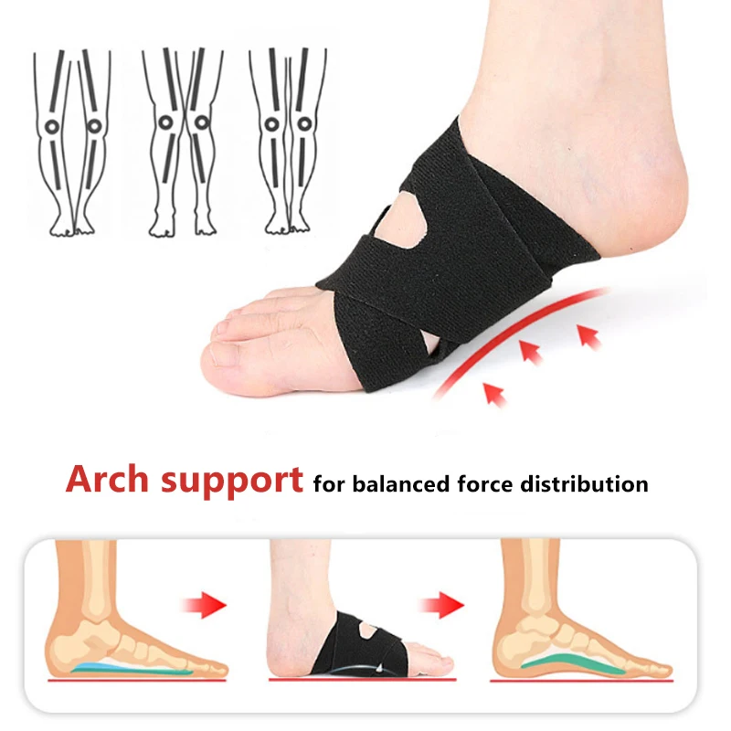 2 PCS Bandage Arch Support Foot Pads Cross Hook & Loop Strap Lock X/O Leg Corrector Foot Sleeve, Elastic, Shock Absorbing