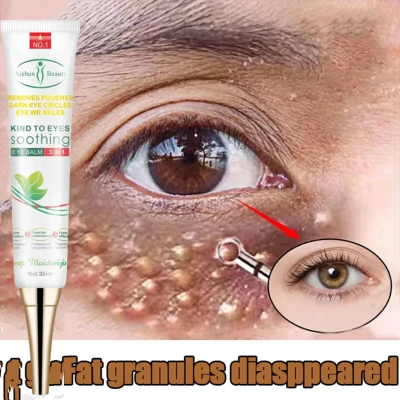 

Fat Granules Remover Eye Cream Anti-puffiness Firming Anti Inflammatory Cream Fade Fine Lines Remove Dark Circles Eye Skin Care