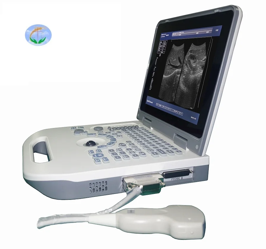 Low Price animal b ultrasound Full Digital Laptop Ultrasound Machine YJ-X50 Brand human ultrasound machine