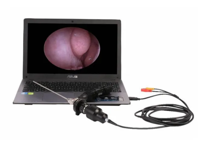 USB Port Video Otoscope . Portable Laptop Endoscope Camera For ENT