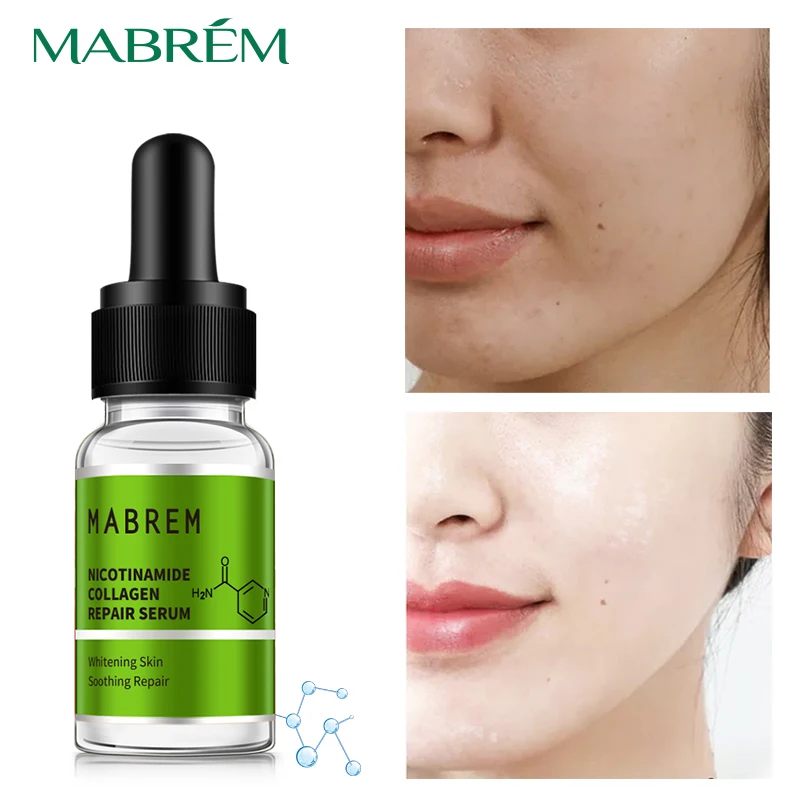 MABREM Nicotinamide Collagen Repair Solution Serum Whitening  Oil control Acne Delicate skin Facial serum Skin care  face care