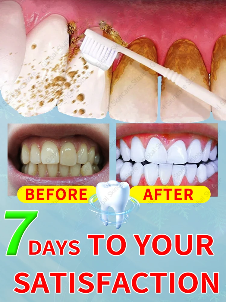 

Tartar removers dissolve tartar and remove stains