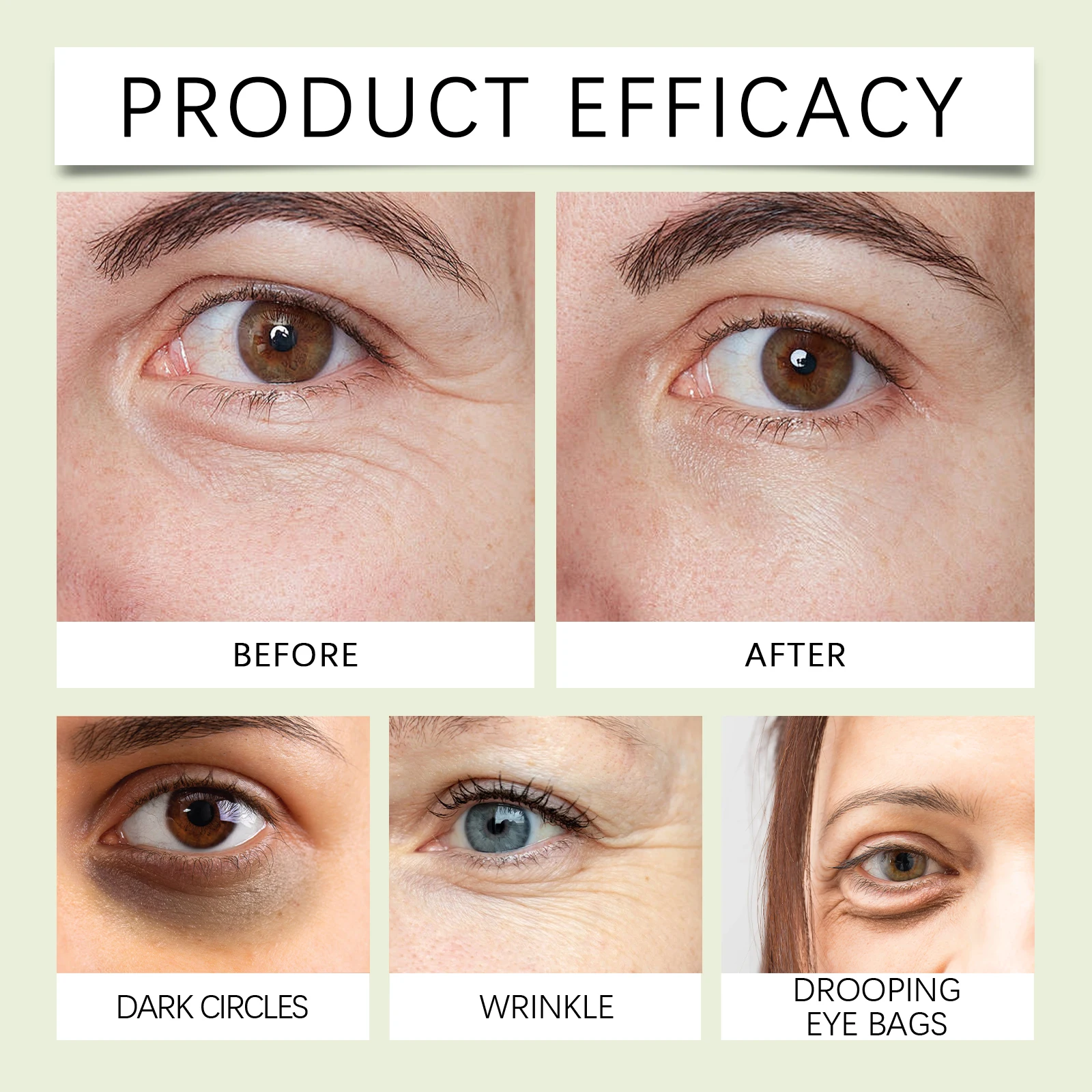 Thumbnail 2 - #11 Skin Care Rollers Comparison Guide