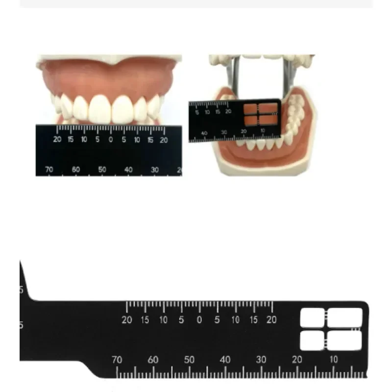 Regla de medición de precisión para fotografía Dental, herramienta médica, escala, calibre de fotografía endodóntica, accesorios de doble cara