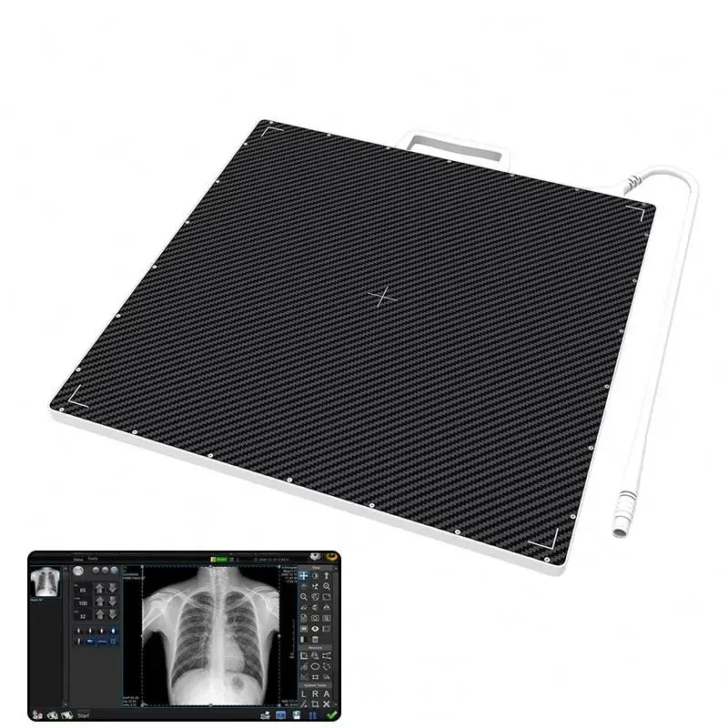 Cheapest Digital Wired Flat Panel X- Ray Machine Detector