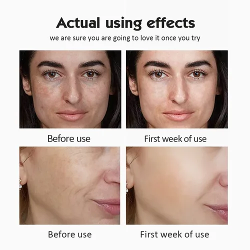 Imagen 2 del producto Juego de suero de ampolla de vitamina C 20%, blanqueamiento hidratante, reducción de arrugas, suero antienvejecimiento, belleza facial, cuidado de la piel