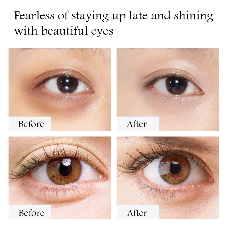 1/2/3pcs Gold Caviar Eye Cream Anti Dark Circle Wrinkle Removal Eyes Bags Moisturizing Firming Eye Creams Skin Care - view 5