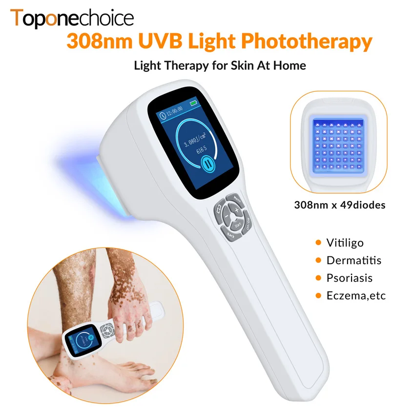 Home Use Psoriasis Equipment 308nm UV Lamps Phototherapy Medical Device UVB Treatment Lamp for Psoriasis Vitiligo 49 Diodes