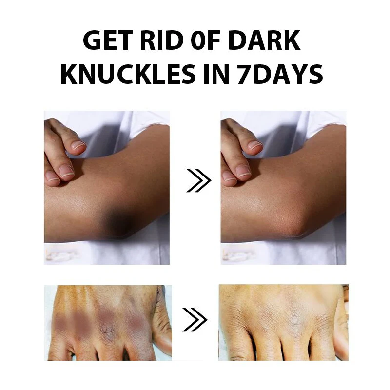 Gluta Master Removing stains Body Lotion Whitening Brightening Skin Knuckles Knees Elbows Anti-Aging Smoothing Skincare Product