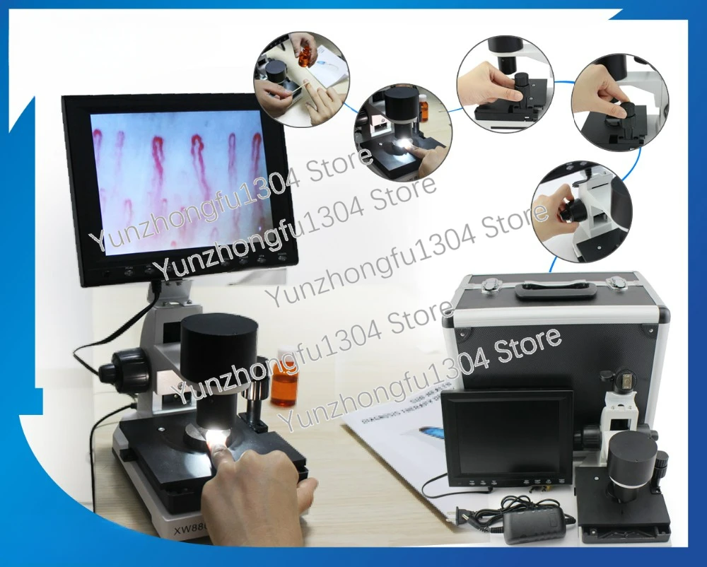 High Definition Magnifier Blood Capillary Nailfold Capillaroscopy Microcirculation Detector