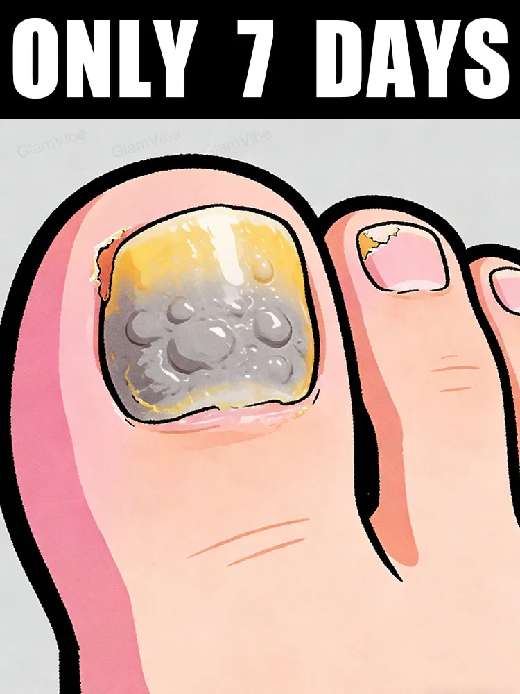 

New 2026 Offer! Free Shipping! Tea Tree Nail Solution 10ml