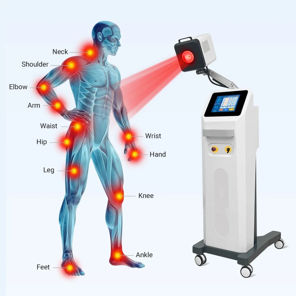 2026 High Intensity Knee Pain Relief Class 4 Laser Therapy for Osteoarthritis Sciatica High Power Physiotherapy Physical Machine