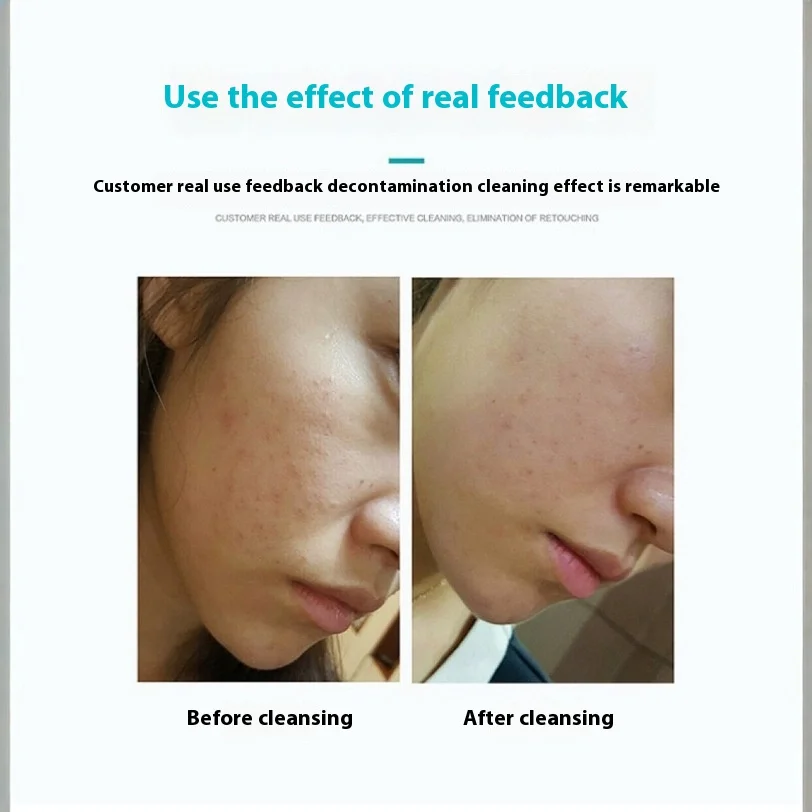 Draagbare draagbare elektrische siliconen gezichtsborstel Gezichtsreiniger Poriereiniging Massage Ultrasone gezichtsreiniger