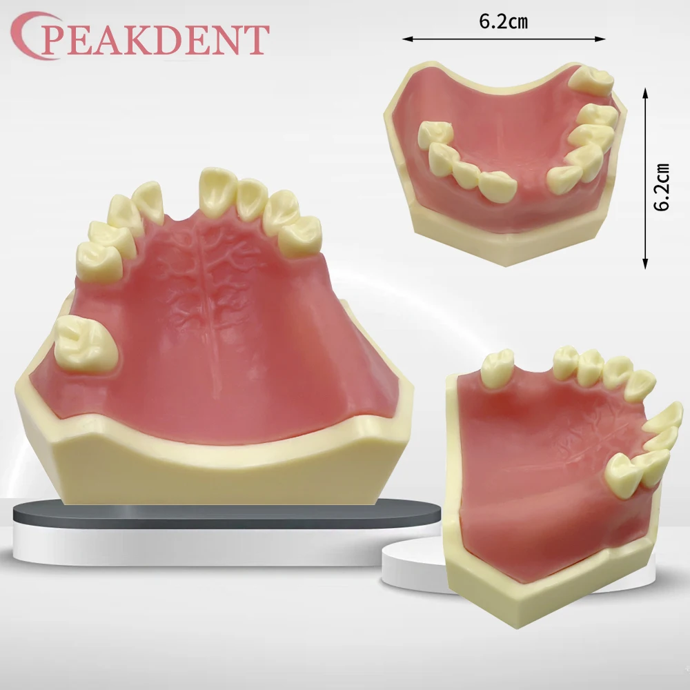 

Dental Teeth Model Dental Maxillary Sinus Implantation Practice Model For Training Studying Patient Education Dentist Studying