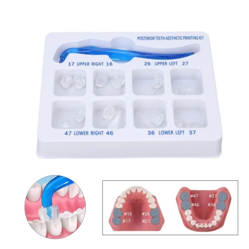 Dental Orthodontic Posterior Teeth Aesthetic Printing Kit Printing Restoration Teeth Quick Built Dentistry tools Material