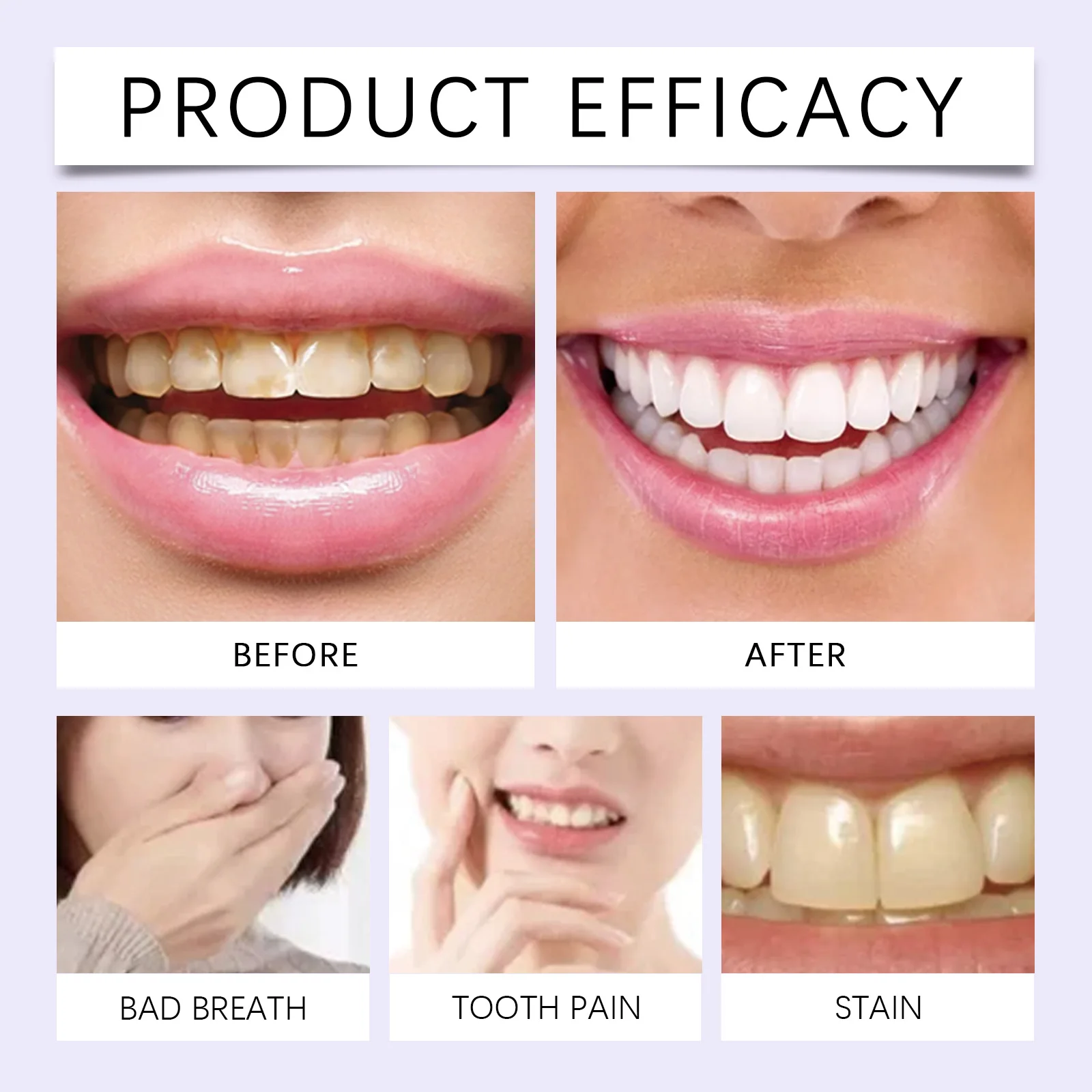 2 Pairs Purple Teeth Strips, Smile Care Oral Beauty Stickers, Easy Home Use Gentle Fit Daily Smile Routine view 5