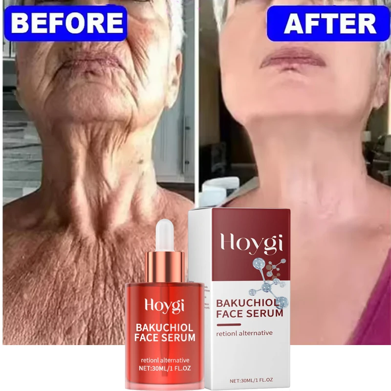 

Retinol Instant Wrinkle Removal Face Essence Lifting Firming Anti-Aging Products Fade Fine Lines Repair Serum Korean Cosmetics