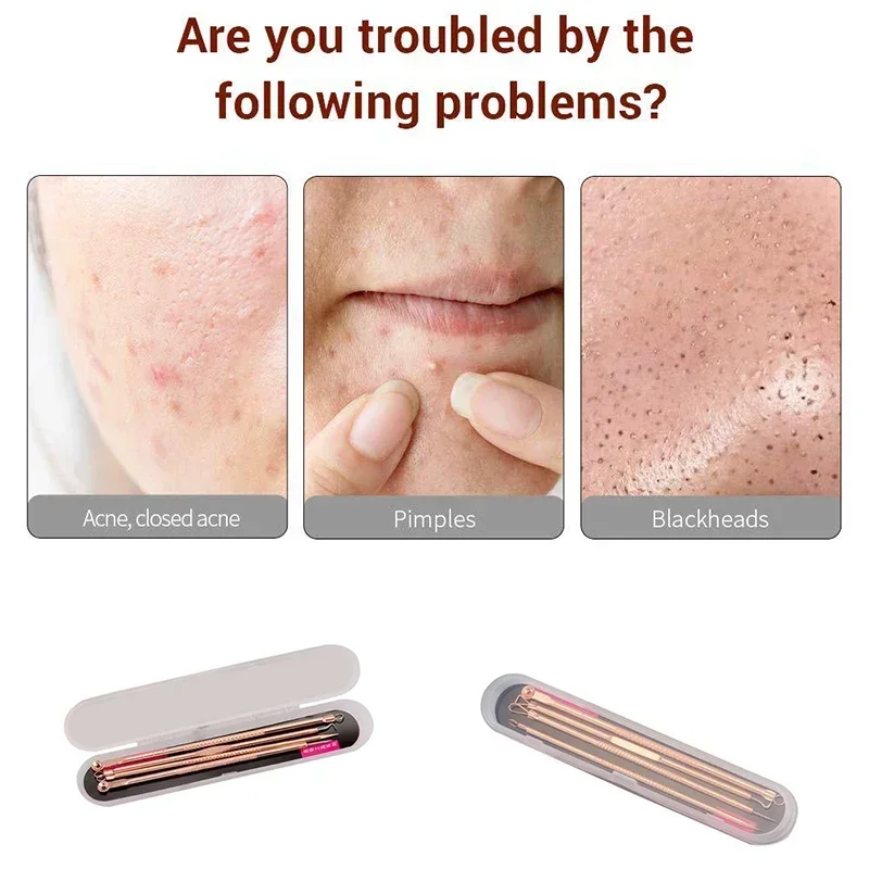 4pcs Blackhead Pimple Pin Acne Set Beauty Needle Stainless Steel Acne Needle Pimple Needle Acne Removal Tools New Makeup
