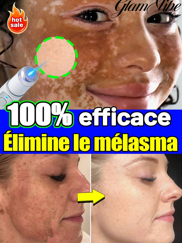 Spot Removal Tool for skin Stains Eliminates Moles And Spots Restores Original Skin Condition Leaves Skin Clean And Bright