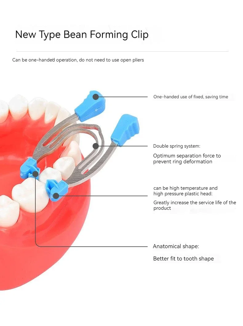 Odporne na wysokie temperatury dentystyczne Matryce segmentowe Klipsy do matryc segmentowych Zaciski profilowane