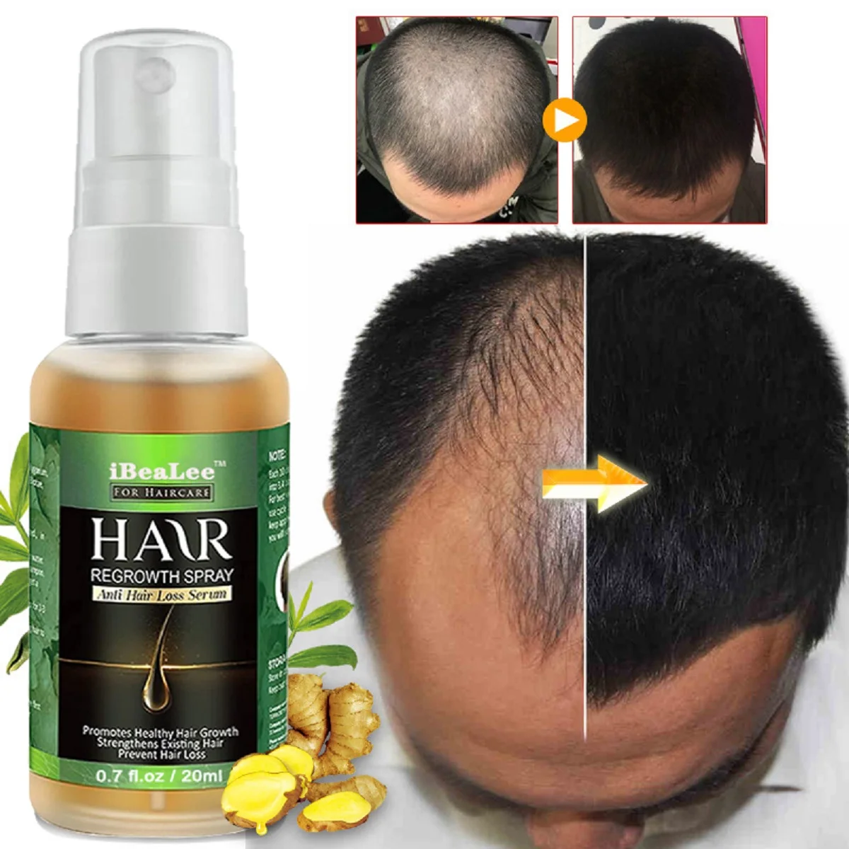 Biotin Hair Growth Solution Hair Loss Treatment Beard Eyelash Growth Oil Serum Fast Hair Growth Serum For Men Ladies Spray 30ml