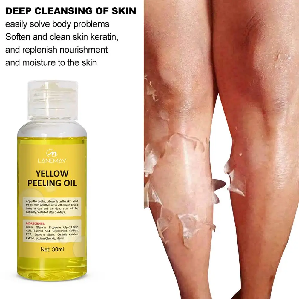 Óleo de Peeling para Pele Negra, Remove Força, Amarelo, Forte, Óleo de Peeling para Clareamento da Pele, Hidratante, 30ml, F0M1