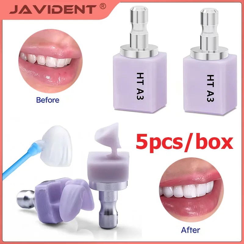 Dental Materials All-Ceramic Dental Crown Glass-Ceramic Blocks Aesthetic Chairside Restoration Ceramic Blocks Dental Laboratory